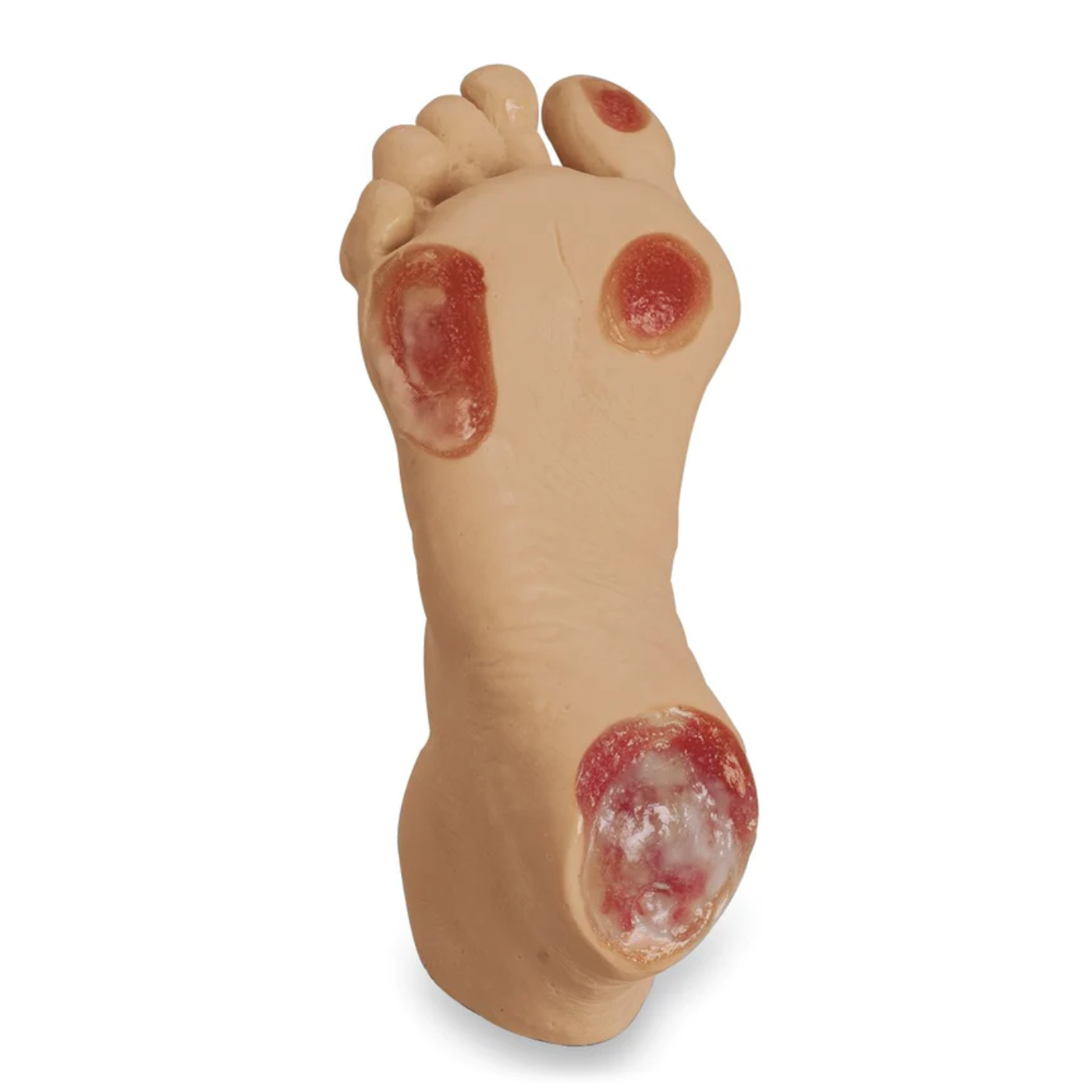 Elderly Pressure Ulcer Foot - Light - Nasco